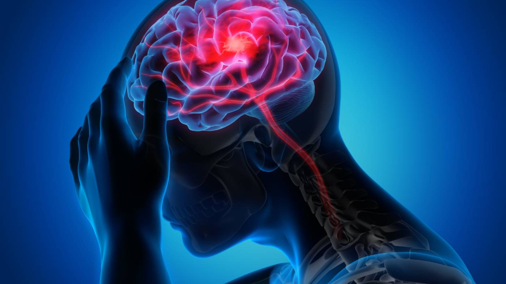 Physiotherapie_und_Schlaganfall