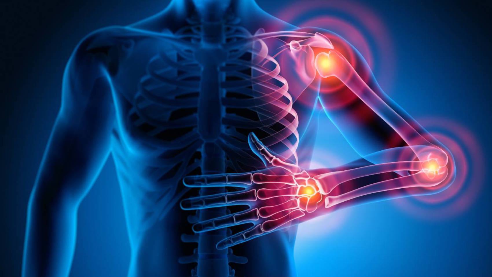 Physiotherapie_und_Schmerzpunkte